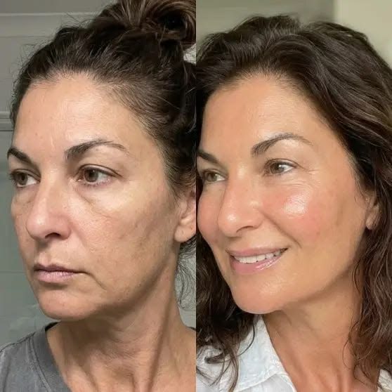 Hannah, 40